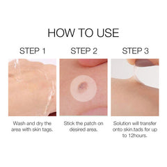Wart Patch A Box Of Two Face Wart Skin Tag Removal Patches