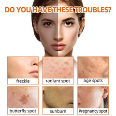 Turmeric Face Soap Facial Repair Gentle Cleansing Mite Removal Spot Fine Lines